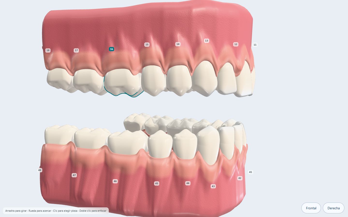 Gestión dental — Periodontograma original · vista 3D